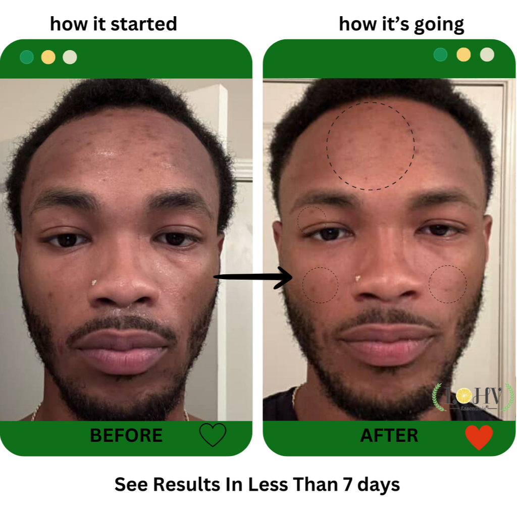 PREMIUM 100% VEGAN GLOW UP Toner Serum With Hyaluronic Acid + Niacinamide + Camellia Leaf + Vitamin E + Rose Water